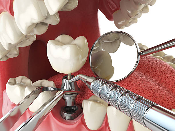Best Emergency Gum Treatment in Soledad, CA